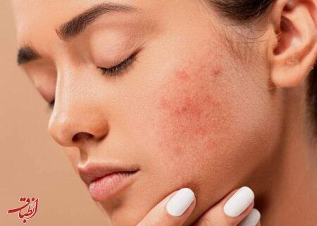 با مصرف این ۶ خوراکی‌ زود پیر می‌شوید